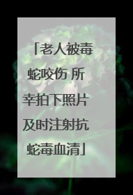 老人被毒蛇咬伤 所幸拍下照片及时注射抗蛇毒血清